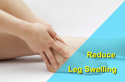 Reduce leg swelling issues compression socks
