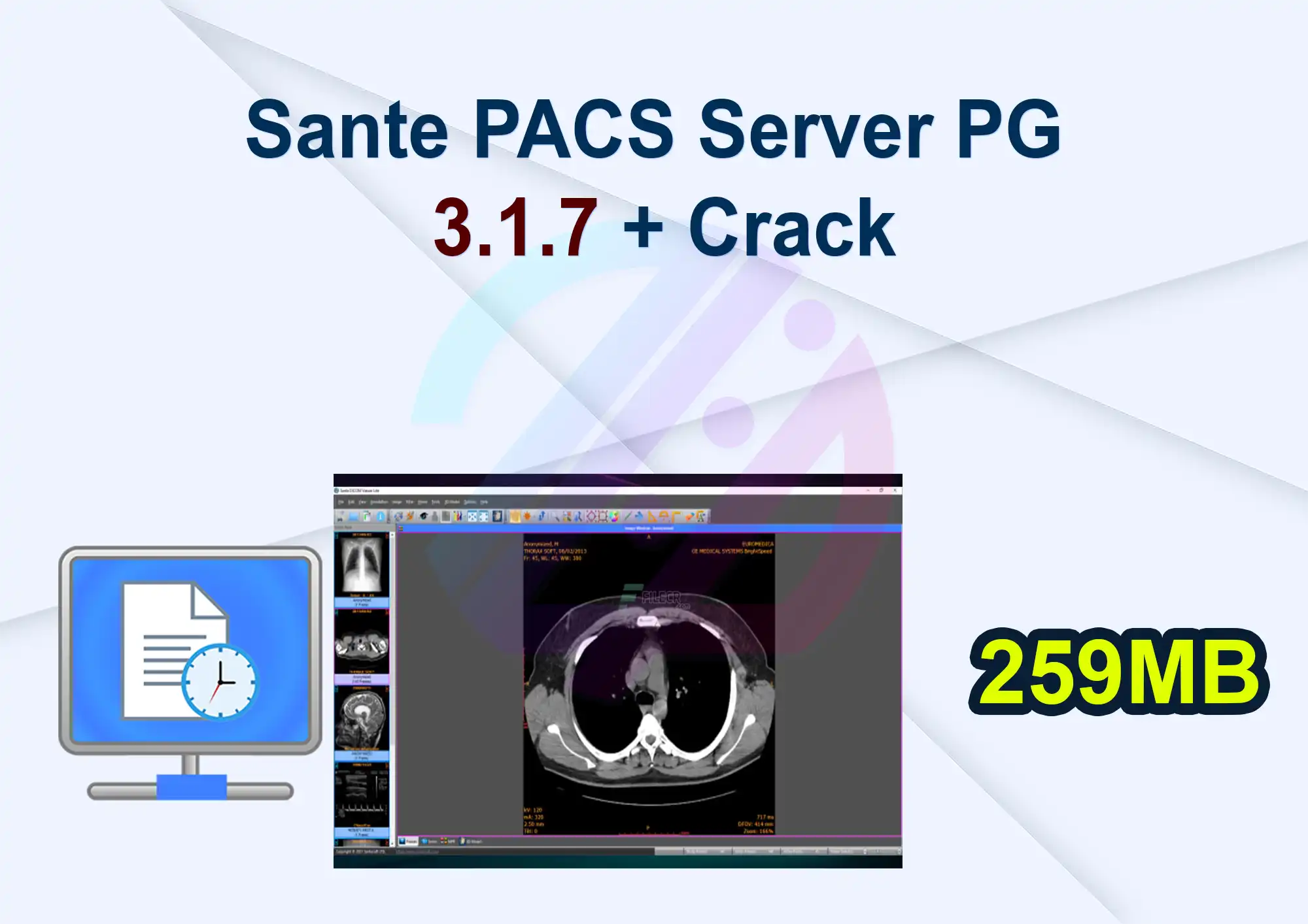Sante PACS Server PG 3.1.7 + Crack