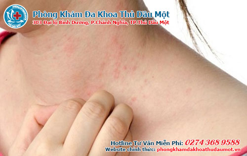 kỹ thuật trị giang mai hiệu quả tại Đa khoa Thủ Dầu Một