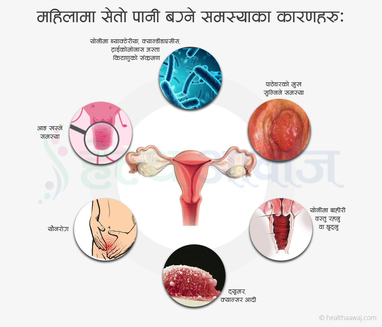 कसरी DXN को प्रोडक्ट द्वारा महिलाका Gynecological Problem समस्यालाई ठिक पर्नु सकिन्छ ?