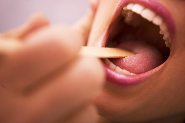 ciri dan gejala kanker lidah