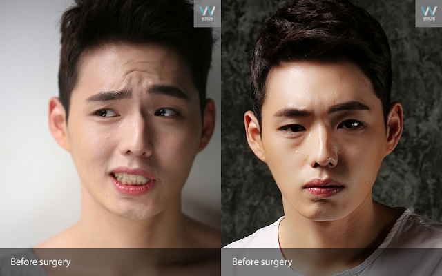 men plastic surgery