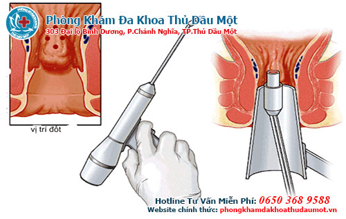 Sử dụng các thủ thuật điều trị hiệu quả