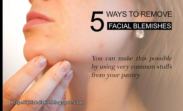 5 Ways to Remove Facial Blemishes