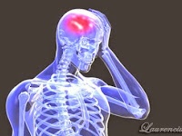 Berita Sehat -Tips Mencegah Penyakit Stroke dengan Mudah- SEHATERUS