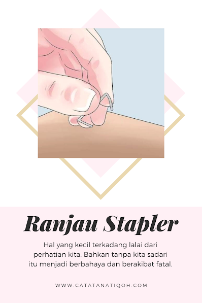 RANJAU STAPLER