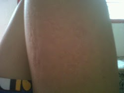 It back :( ☹☹☹☹