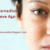 Home Remedies To Remove Age Spots