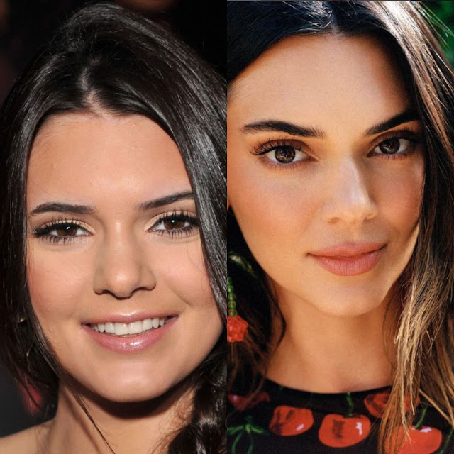 Kendall Jenner antes (2009) vs ahora (2024)