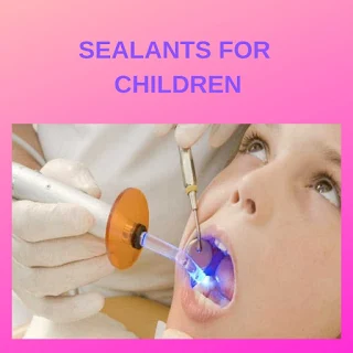 Dental sealants for children