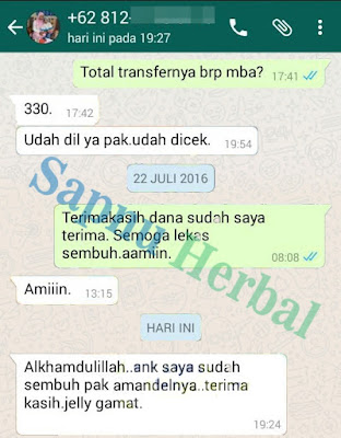 Cara Mengobati Amandel Bengkak Tanpa Operasi