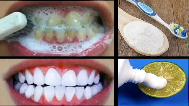 اكتشف السر السحري لأسنان بيضاء مثل الثلج في دقائق قليلة - تعرف على المكون السحري لتبييض الأسنان وإزالة الجير والاصفرار