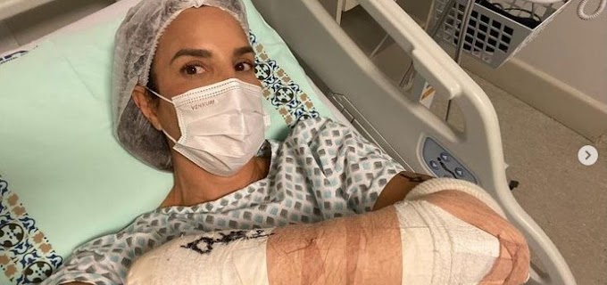 Após sofrer acidente esquiando no exterior, Ivete passa por cirurgia no braço