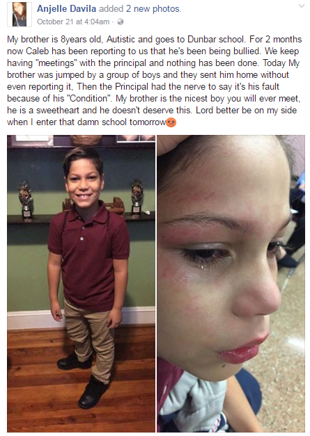 This Special Child Is Being Bullied At School. What The Principal Did Will Surely Make You Angry!