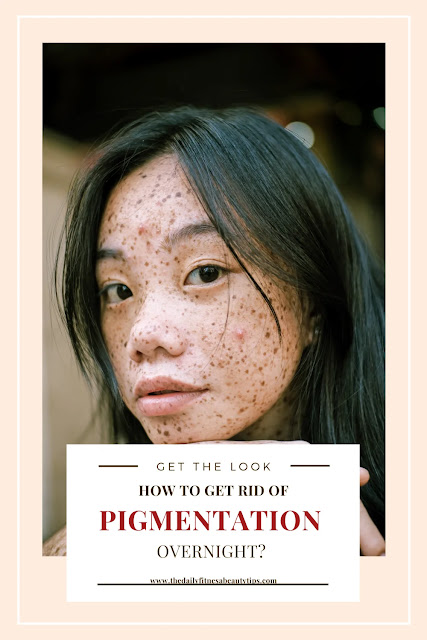 skin-pigmentation-remedy