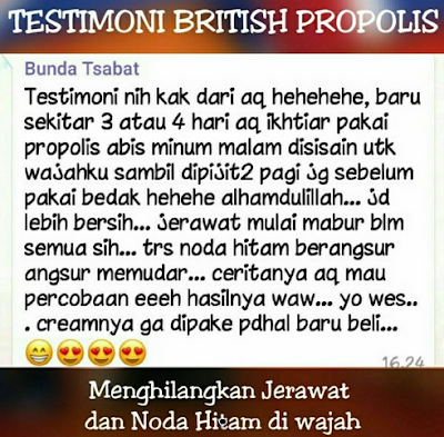 Review British Propolis untuk Jerawat Di Solo