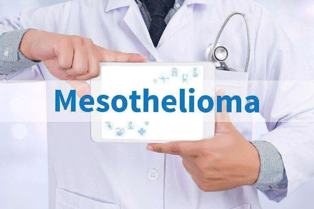 Mesothelioma Stages