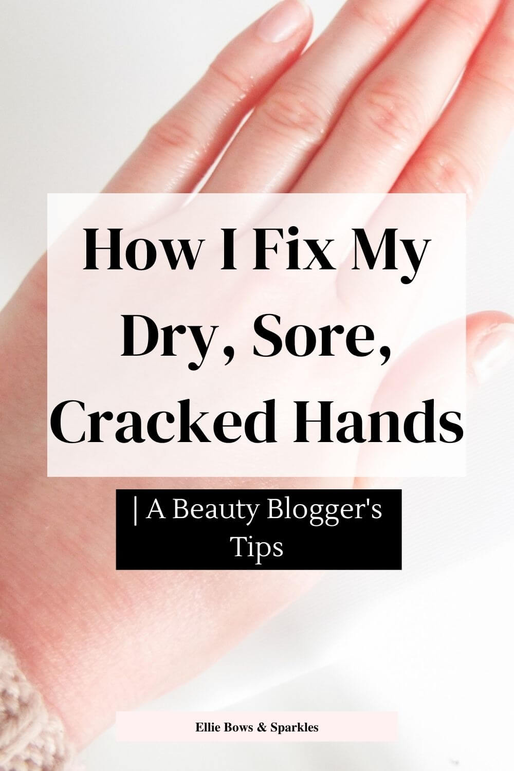 Pinterest pin, featuring picture of my red, dry hands in the background, with white translucent title card and black, bold text reading "How I Fix My Dry, Sore, Cracked Hands" and black box below, with white font reading "| A Beauty Blogger's Tips".