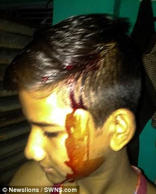 Indian boy suffers mysterious condition that causes him to bleed from his ear, eyes, mouth and hairline up to 10 times daily