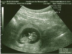 Baby11Weeks0002