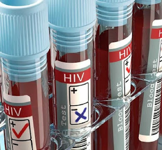 5 CURED Of HIV/AIDS After Using New Vaccine