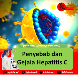 Penyebab dan Gejala Hepatitis C