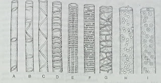 Thickening of the cell wall-digieduco