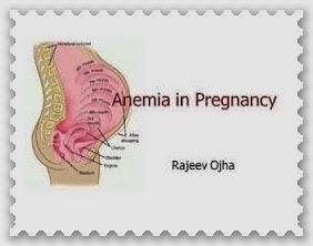 Anemia & Kekurangan Darah Wanita Hamil