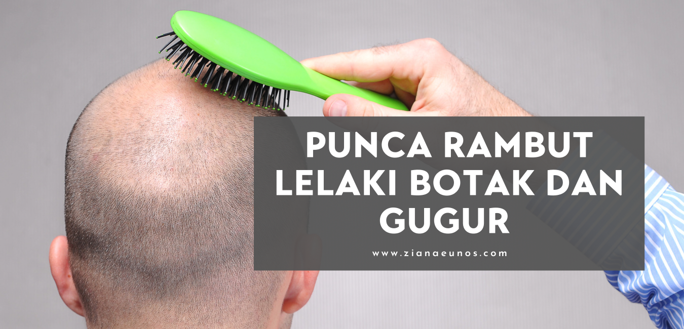 Punca Rambut Lelaki Cepat Gugur dan Botak