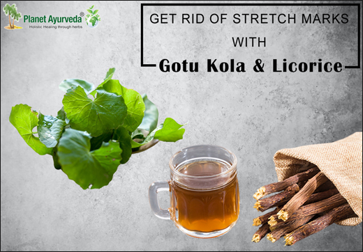 Gotu Kola, Licorice, Extract Of Gotu Kola, Treat Stretch Marks, Ayurvedic Treatment, Causes, Ayurvedic Treatment For Stretch Marks, Diagnosis, Ayurvedic Herbs, Yashtimadhu