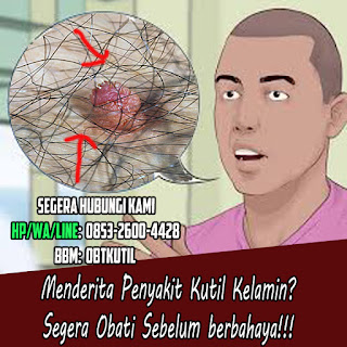 Obat Kutil Kelamin