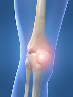 knee pain