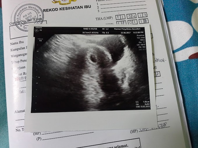 My 1st scanning + 5 days spotting