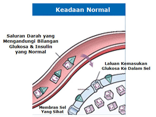 MAKLUMAT KESIHATAN DAN PENYAKIT: RINTANGAN INSULIN