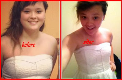 Before after weight loss
