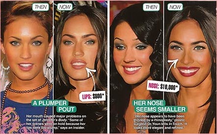 Megan Fox Plastic Surgery Before After