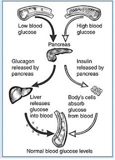 Causes of Diabetes