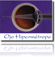 ojohiper