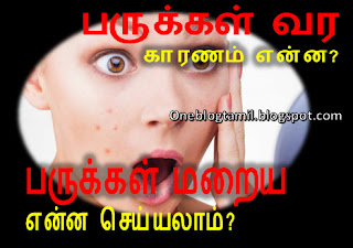 Parukkal vara kaaranam Enna? Parukkal maraiya Enna Seyyalaam? , paru poga iyarkai maruthuvam,mugaparu poga enna pannanum, mugaparu maraiya tips in tamil mugathil karumpuli poga tamil, mugaparu treatment mugaparu treatment tamil.  mugaparu thalumbu, mugaparu kuraiya tips in tamil, mugaparu pallam, Muga Paru Neenga Pengalukku Tips