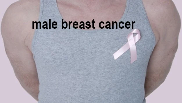 Male breast cancer - Warning Signs, Symptoms, Causes and Treatment