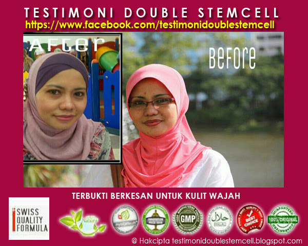 Gambar Testimoni wajah cantik dengan stemcell