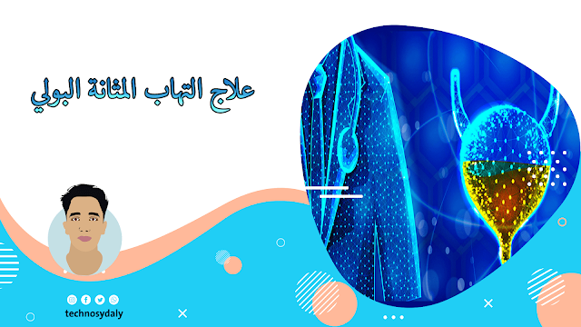 علاج التهاب المثانة-الأسباب والأعراض وطرق العلاج المختلفة بالادوية