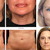 Look at How to Eliminate Flaccidity and Tensar the Skin Naturally YOU WILL LOOK YOUNGER!