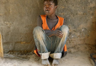 Boy with nodding disease