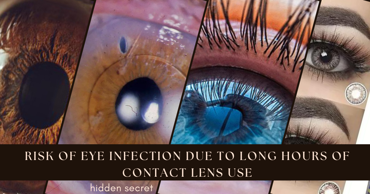 Don't overuse your contact lenses;  Follow these tips to prevent eye infections and complications