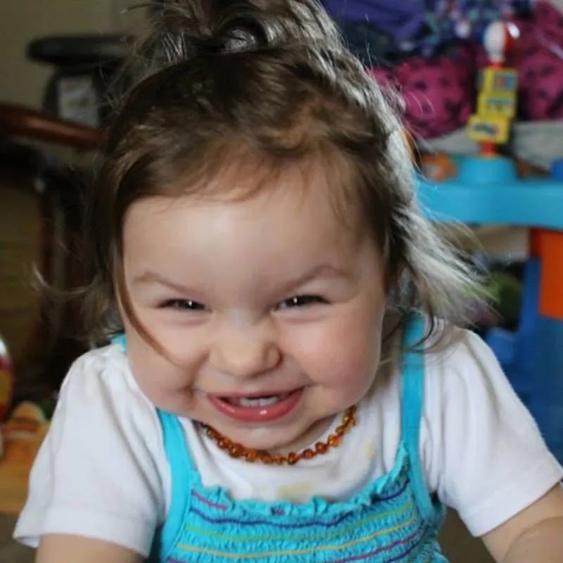 Children with Angelman syndrome always smile and seem cheerful, but no one knows what is going on in their souls.