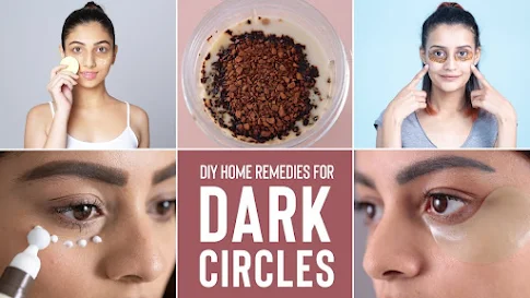 Natural ways to remove dark circles under your eyes permanently at home