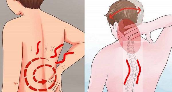 Sering Sakit Leher atau Otot Kaku? Yuk Redakan dengan 3 Jenis Latihan Sederhana ini!