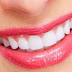 Liệu Pháp laser Whitening tại Nha Khoa Đăng Lưu