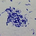 Mengenal Bakteri Bacillus polymyxa